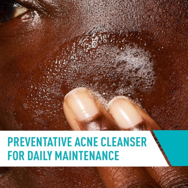 CeraVe Acne Control Cleanser, 2% Salicylic Acid Acne Treatment Formulated With Niacinamide + Ceramides + Oil Absorbing Clay, Gentle Acne Face Wash Helps Clear and Prevent Acne, Fragrance Free, 16 Ounce - Image 4