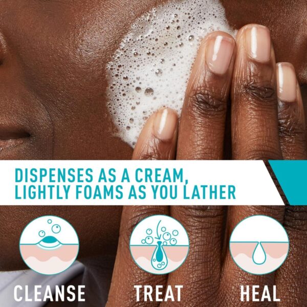 CeraVe Acne Foaming Cream Cleanser | Acne Treatment Face Wash with 4% Benzoyl Peroxide, Hyaluronic Acid, and Niacinamide | Cream to Foam Formula | Fragrance Free and Non Comedogenic | 5 Oz - Image 3