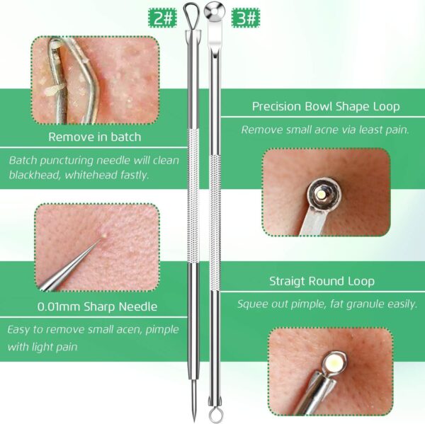 5PCS Blackhead Remover Comedone Extractor, Curved Blackhead Tweezers Kit, Professional Stainless Pimple Acne Blemish Removal Tools Kit - Image 4