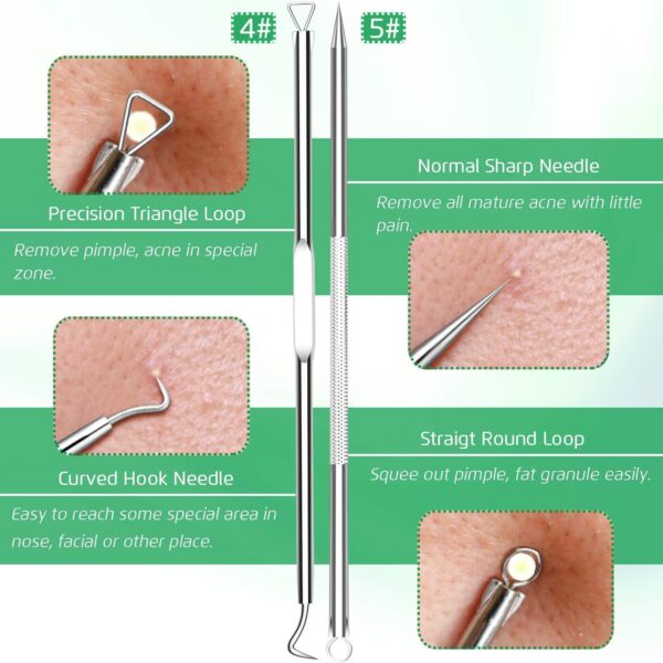 5PCS Blackhead Remover Comedone Extractor, Curved Blackhead Tweezers Kit, Professional Stainless Pimple Acne Blemish Removal Tools Kit - Image 5