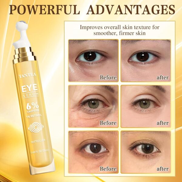 6% Caffeine Eye Cream for Dark Circles, Daily 1% Retinol Caffeine Eye Serum for Puffy Eyes and Under Eye Bags, Eye Skin Care Suitable for Men and Women's - Image 5