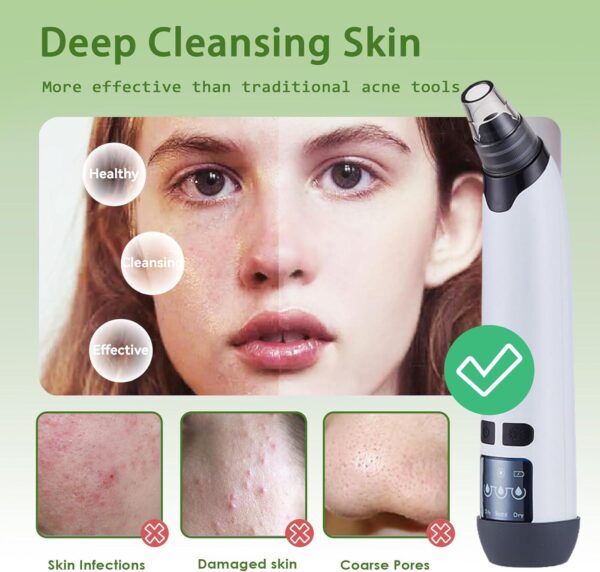 Blackhead Remover Vacuum - Black Head Remover for Face,Blackhead Extractor Tool with 3 Adjustable Suction Levels,4 Probes,USB Interface Type Pore Vacuum,Suitable for Women and Men (White) - Image 5