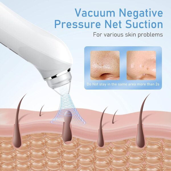Blackhead Remover Vacuum, USB Interface Type Pore Vacuum, Black Head Extractions Tool with Camerafor, Men and Women Pore Cleaner, 3 Adjustment Modes and 6 Suction Heads(Light Pink) - Image 3