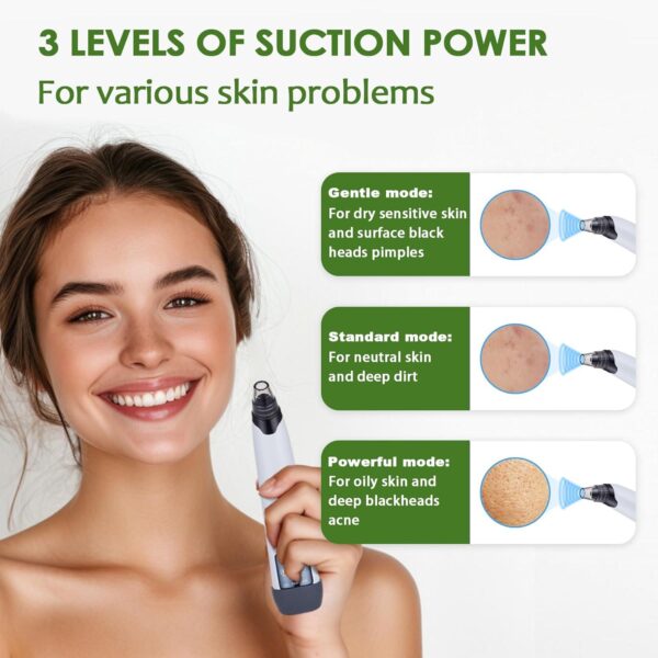 Blackhead Remover Vacuum - Black Head Remover for Face,Blackhead Extractor Tool with 3 Adjustable Suction Levels,4 Probes,USB Interface Type Pore Vacuum,Suitable for Women and Men (White) - Image 2