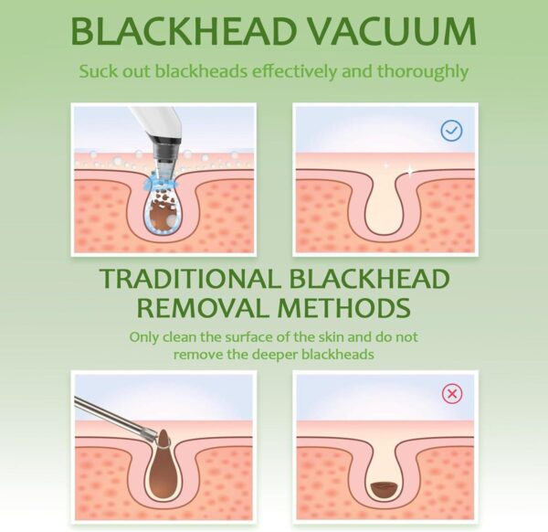 Blackhead Remover Vacuum - Black Head Remover for Face,Blackhead Extractor Tool with 3 Adjustable Suction Levels,4 Probes,USB Interface Type Pore Vacuum,Suitable for Women and Men (White) - Image 7