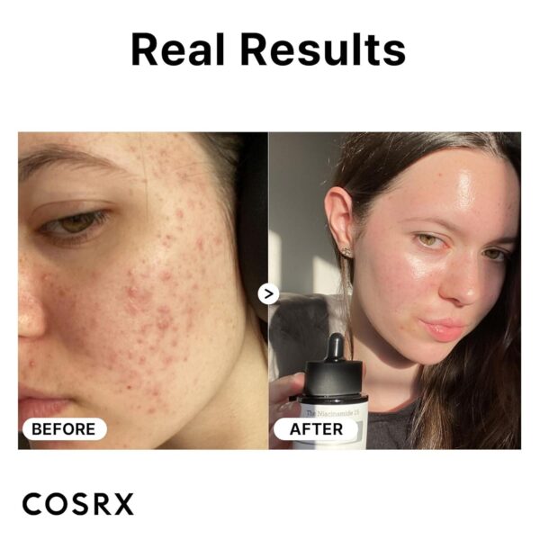 COSRX 15% Niacinamide Face Serum, 0.67 fl oz, Pore Minimizer Serum for Face, Even Skin Tone, Korean Skin Care - Image 4