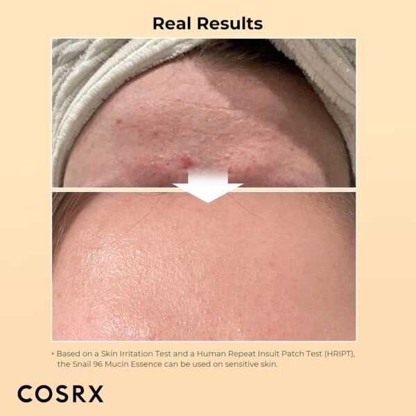COSRX Snail Mucin 96% Power Face Serum 3.38 fl oz 100ml, Hydrating Serum for Face, Self Care, Glow Skin under Makeup, Korean Skin Care, Korean Beauty - Image 3