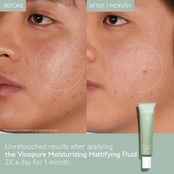 Caudalie Vinopure Oil Control Moisturizer for Acne Prone Skin, Hydrating and Mattifying Moisturizer, 1.35 Fl Oz - Image 2
