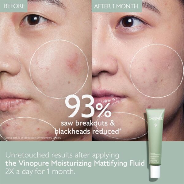 Caudalie Vinopure Oil Control Moisturizer for Acne Prone Skin, Hydrating and Mattifying Moisturizer, 1.35 Fl Oz - Image 3