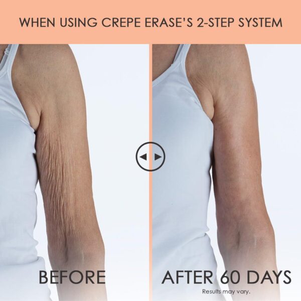 Crepe Erase Advanced Body Repair Treatment, Anti-Aging Wrinkle Cream for Face and Body, Support Skins Natural Elastin and Collagen Production - 10oz - Image 4