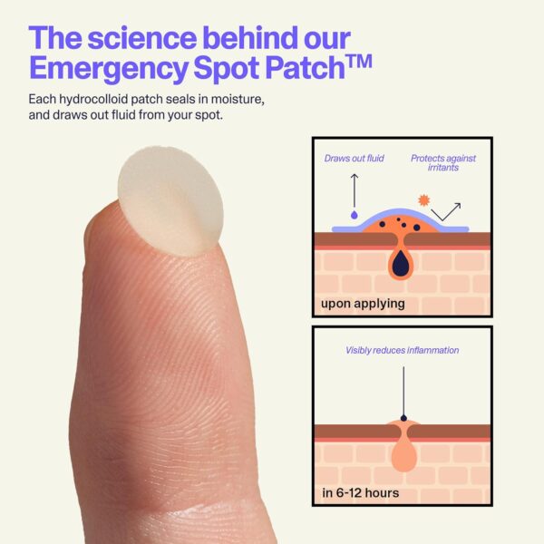 Curology Emergency Spot Pimple Patches for Face, Hydrocolloid Pimple Patches Fast-Acting Support, Spot Concealing and Oil Absorbing, 80 Count - Image 4
