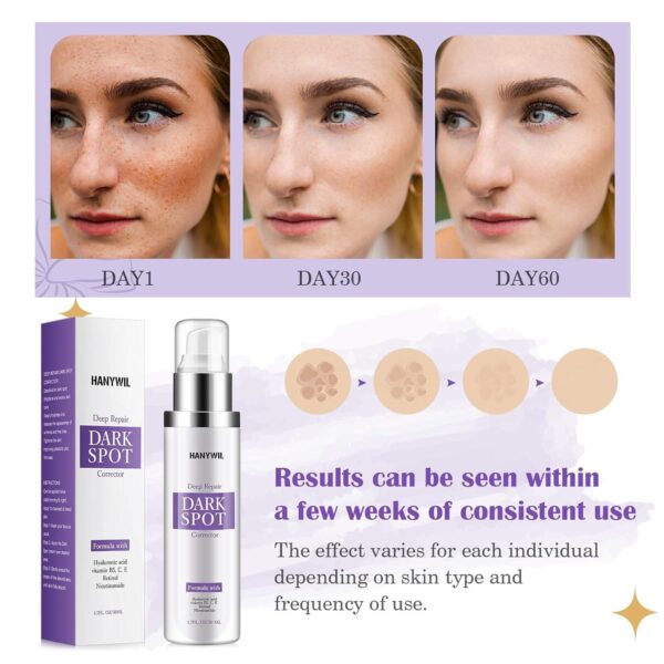 Dark Spot Remover for Face and Body, Dark Spot Corrector Cream, Skin Brown Spot Remover, Skin Care Face Cream, Sun Spot Remover, Age Spot Corrector, Rapid Tone Repair Retinol (1.7 Fl Oz) - Image 6