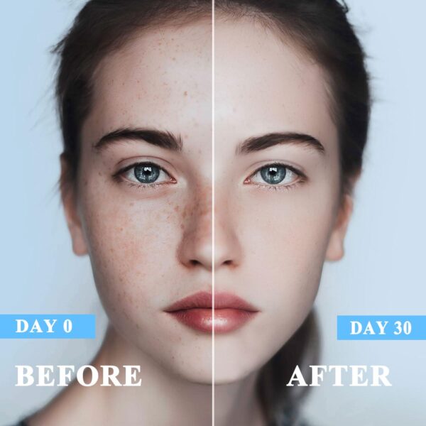 Dark Spot Remover for Face, Dark Spot Corrector Cream for Age Spot Sun Spot Melasma Freckles, Dark Spot Remover for Body, Skin Care Face Cream for Women and Men (1.7 Fl Oz) - Image 6