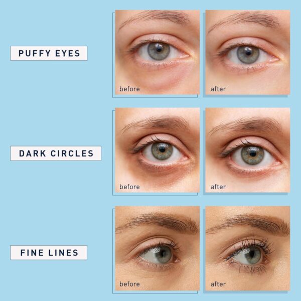 Enaskin Naturals Under Eye Patches for Dark Circles: 30 Pairs Retinol Collagen Eye Gels Mask - Reduce Wrinkles Puffy and Bags - Skin Treatment Pads - Anti Aging Moisturizer For Women (Blue) - Image 4