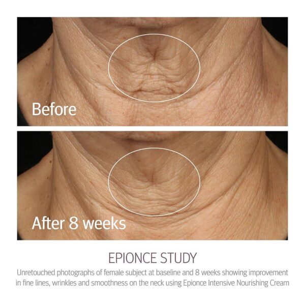 Epionce Intensive Nourishing Cream - Anti Aging Face Cream, Dry Skin Barrier Repair Moisturizer Face, Dimethicone, Glycerin, and Ceramide Moisturizer - Image 3