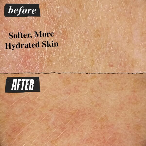 Kiehl's Ultra Facial Cream, with 4.5% Squalane to Strengthen Skin's Moisture Barrier, Skin Feels Softer and Smoother, Long-Lasting Hydration, Easy and Fast-Absorbing, Suitable for All Skin Types - Image 3