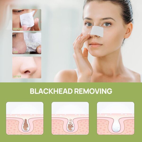 LANBENA Blackhead Remover - Peel Off Mask for Nose and Face, Blackhead Removal Kit 1.05oz - Image 4