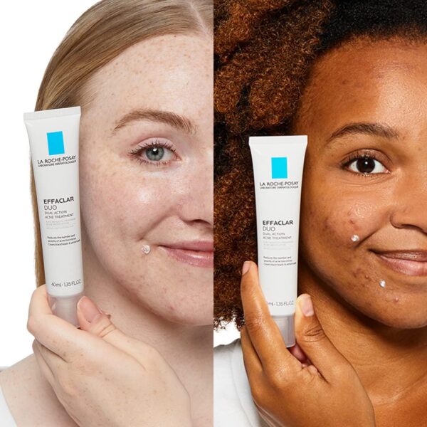 La Roche-Posay Effaclar Duo Dual Action Acne Spot Treatment Cream with Benzoyl Peroxide Acne Treatment for Acne and Blackheads, Lightweight Sheerness, Safe For Sensitive Skin - Image 10