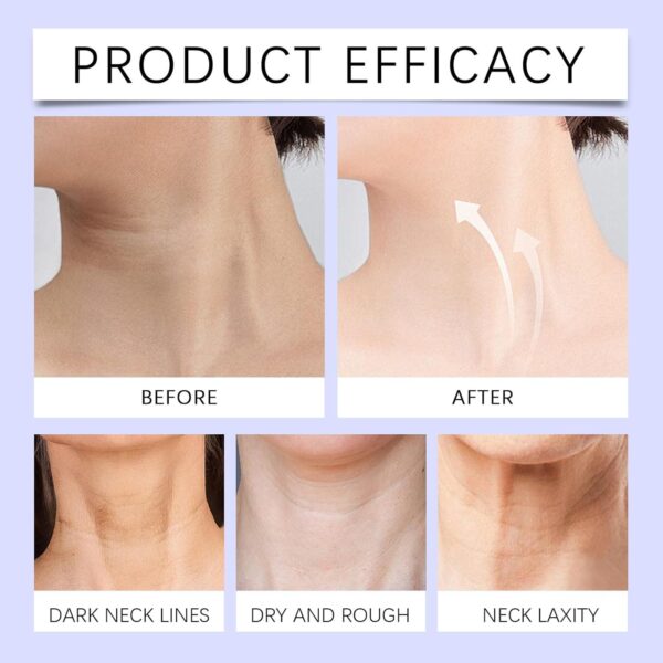 Neck Creams for Tightening and Firming, Neck Firming Cream, Aging Treatment for Wrinkles Sagging Skin for an Even Skin Tone and Neck Lift with Pro-Active Firming Complex - Image 6