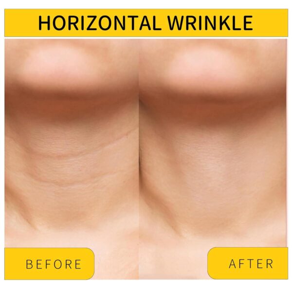 Neck Tightening Cream, Neck Cream, Skin Tightening Cream for Face, Neck, Chest and Décolleté, Neck Firming Cream for Tightening and Wrinkles for an Even Skin Tone and Neck Lift - Image 4