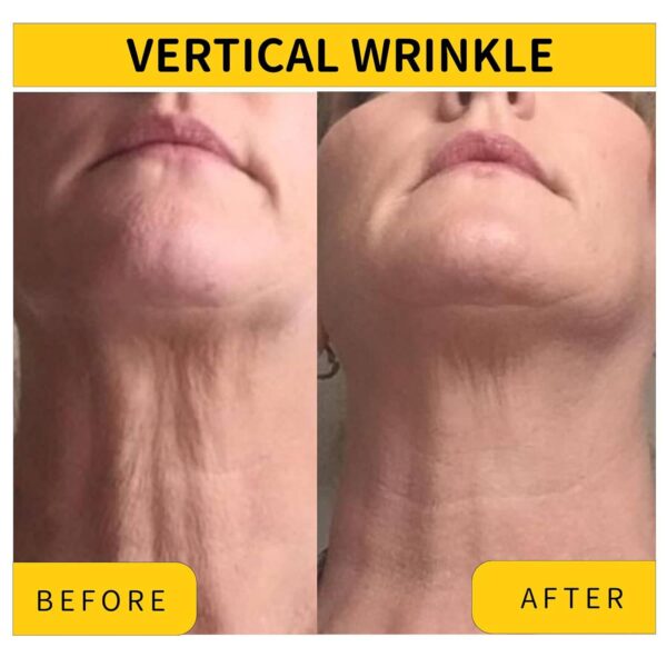 Neck Tightening Cream, Neck Cream, Skin Tightening Cream for Face, Neck, Chest and Décolleté, Neck Firming Cream for Tightening and Wrinkles for an Even Skin Tone and Neck Lift - Image 3