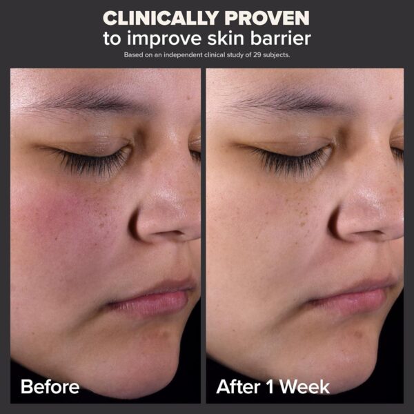 Paula's Choice SKIN PERFECTING 2% BHA Liquid Salicylic Acid Exfoliant-Facial Exfoliant for Blackheads, Enlarged Pores, Wrinkles and Fine Lines - Image 2
