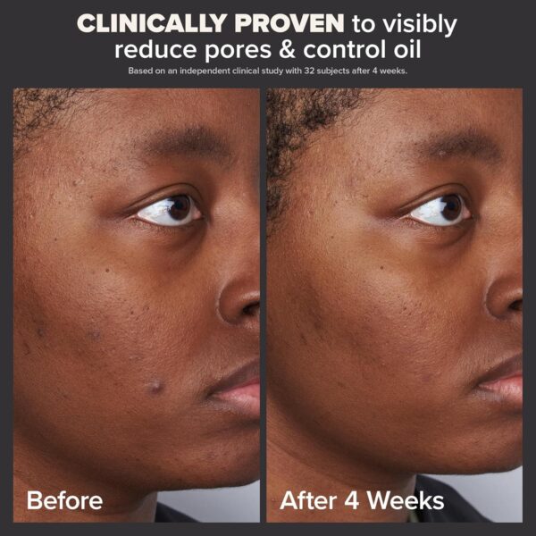 Paula's Choice SKIN PERFECTING 2% BHA Liquid Salicylic Acid Exfoliant-Facial Exfoliant for Blackheads, Enlarged Pores, Wrinkles and Fine Lines - Image 3