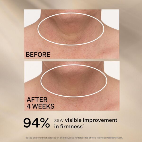 StriVectin Tighten and Lift Advanced Neck Cream PLUS with Alpha-3 Peptides for Neck and Décolleté, Smoothing Look of Wrinkles and Fine Lines, Improves Crepey Skin and Vertical Lines, for Soft Smooth Skin - Image 6