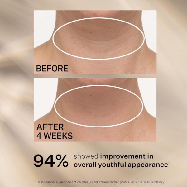 StriVectin Tighten and Lift Advanced Neck Cream PLUS with Alpha-3 Peptides for Neck and Décolleté, Smoothing Look of Wrinkles and Fine Lines, Improves Crepey Skin and Vertical Lines, for Soft Smooth Skin - Image 7