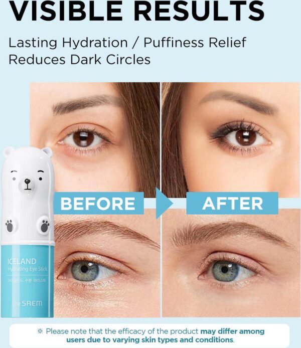 The SAEM Iceland Hydrating Eye Stick 0.24oz - Cooling Eye Balm for Dark Circles and Puffiness Under Eye Treatment - Reduce Wrinkles and Moisturizing - Minimize Dark and Puffy Eyes - Aqua Scent - Image 4