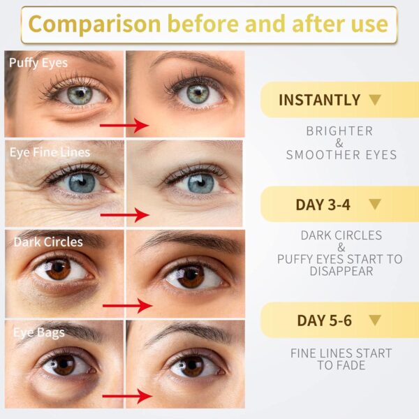 Under Eye Patches - 30 Pairs - 24K Gold Eye Mask- Puffy Eyes and Dark Circles Treatments,Reduce Under Eye Bags and Smooth Wrinkles,Eye Skin Care Pads With Collagen - Image 3