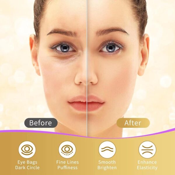 Under Eye Patches, 40 Pairs Eye Mask for Dark Circles, Puffy Eyes, Undereye Bags,Wrinkles,Eye Mask Patches with 24K Gold, Hyaluronic Acid,Rose and Aloe Vera, Eye Treatment Skin Care for Men and Women Gift - Image 4