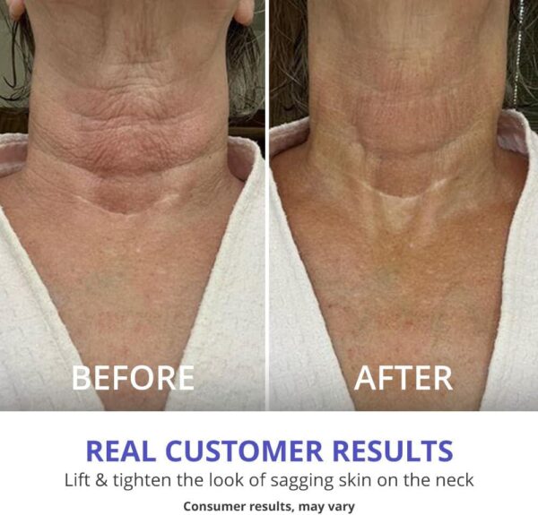 goPure Neck Firming Cream - Anti-Aging Neck Cream for Tightening and Wrinkles for an Even Skin Tone and Neck Lift - With Pro-Active Firming Complex, 1.7 oz - Image 5