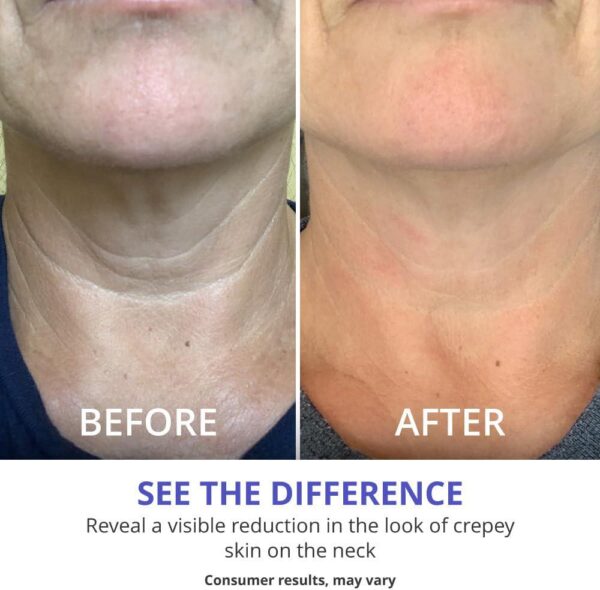 goPure Neck Firming Cream - Anti-Aging Neck Cream for Tightening and Wrinkles for an Even Skin Tone and Neck Lift - With Pro-Active Firming Complex, 1.7 oz - Image 4
