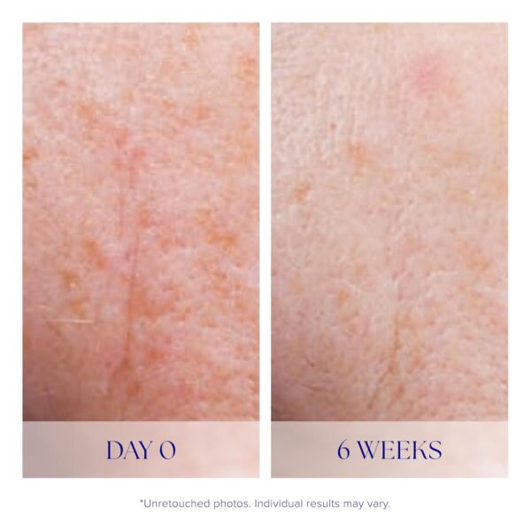 iS CLINICAL Active Serum - Visibly evens skin tone, Excellent for blemish prone skin, Anti-Aging Face Serum - Image 5